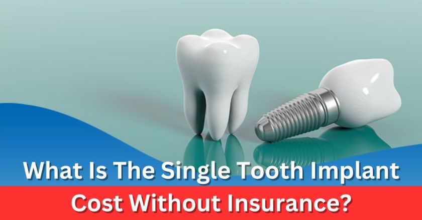 What Is The Single Tooth Implant Cost Without Insurance?