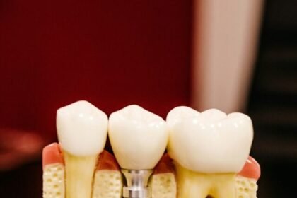 What is the single tooth implant cost without insurance?